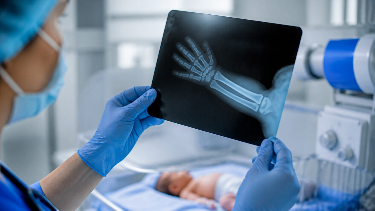 Profissional de saúde observa exame de imagem neonatal para avaliar lesão após o nascimento
